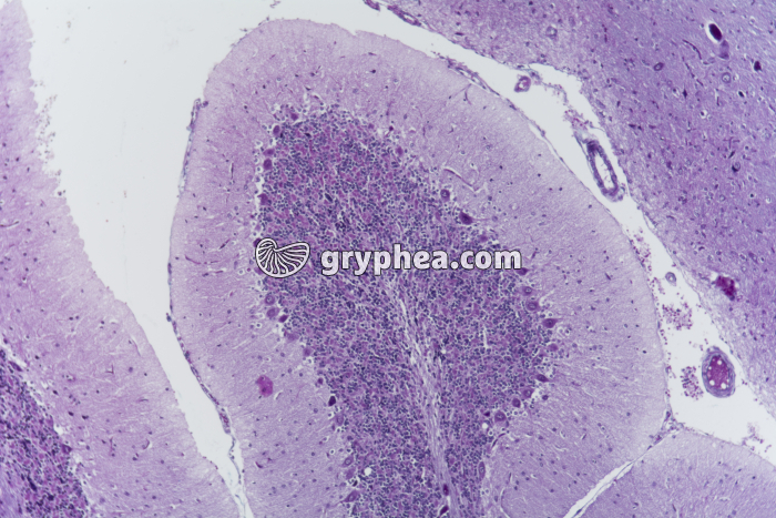 Encéphale CL coupe totale (détail des cellules) x25 - gryphea.com